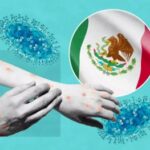 Mexico: Ministry of Health issues alert over monkeypox outbreak